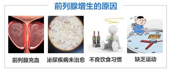 前列腺增生的危害有哪些