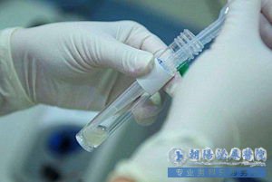 男性做精液检查需要注意哪些问题